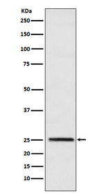 TPI1 Recombinant Rabbit Monoclonal Antibody (K01_3N55)