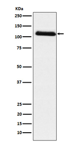 Fibrinogen alpha chain Recombinant Rabbit Monoclonal Antibody (K01_3N56)