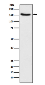 TSC1 Antibody in Western Blot (WB)