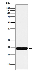 MYL9 Recombinant Rabbit Monoclonal Antibody (K01_3N64)
