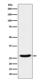 TCF21 Recombinant Rabbit Monoclonal Antibody (K01_3N67)