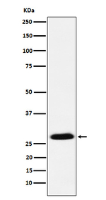 GSC Recombinant Rabbit Monoclonal Antibody (K01_3N70)