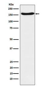 FANCA Recombinant Rabbit Monoclonal Antibody (K01_3N72)