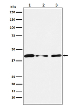 TIN2 Recombinant Rabbit Monoclonal Antibody (K01_3N76)