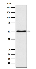SFRP4 Recombinant Rabbit Monoclonal Antibody (K01_3N82)
