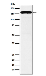 DIAPH1 Recombinant Rabbit Monoclonal Antibody (K01_3N89)