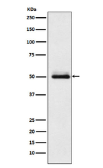CYP2C9 Recombinant Rabbit Monoclonal Antibody (K01_3N91)