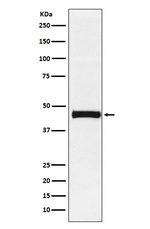 PTX3 Recombinant Rabbit Monoclonal Antibody (K01_3N94)