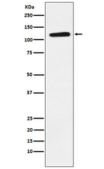 EphB1 Antibody in Western Blot (WB)