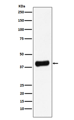 Galectin 8 Recombinant Rabbit Monoclonal Antibody (K01_3P01)