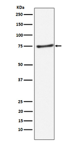 PIAS1 Recombinant Rabbit Monoclonal Antibody (K01_3P10)