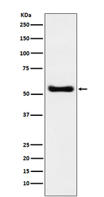 MYST1 Recombinant Rabbit Monoclonal Antibody (K01_3P14)