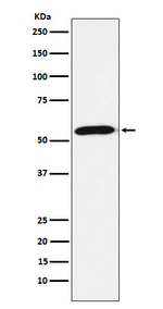 FBXO5 Recombinant Rabbit Monoclonal Antibody (K01_3P15)