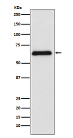 PARP2 Recombinant Rabbit Monoclonal Antibody (K01_3P19)