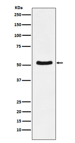 DDX6 Recombinant Rabbit Monoclonal Antibody (K01_3P22)