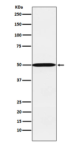 CYP26A1 Recombinant Rabbit Monoclonal Antibody (K01_3P25)