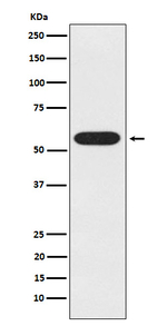 UAP1 Recombinant Rabbit Monoclonal Antibody (K01_3P29)
