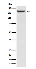 IRS2 Recombinant Rabbit Monoclonal Antibody (K01_3P30)