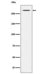 Thyroglobulin Antibody in Western Blot (WB)