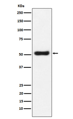 OLFM4 Recombinant Rabbit Monoclonal Antibody (K01_3P36)