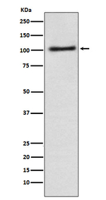 alpha Adaptin Recombinant Rabbit Monoclonal Antibody (K01_3P38)