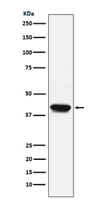 Biglycan Recombinant Rabbit Monoclonal Antibody (K01_3P42)