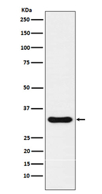 Nkx3.1 Recombinant Rabbit Monoclonal Antibody (K01_3P45)
