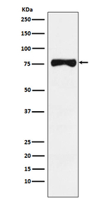 TYRP1 Recombinant Rabbit Monoclonal Antibody (K01_3P47)