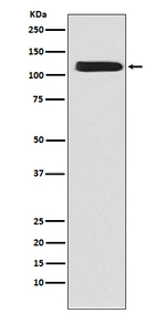 SLC8A1 Recombinant Rabbit Monoclonal Antibody (K01_3P48)