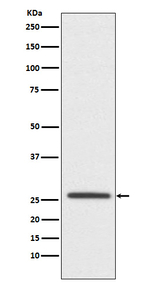 Claudin 11 Recombinant Rabbit Monoclonal Antibody (K01_3P49)