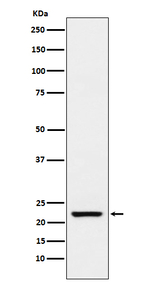 TAGLN Recombinant Rabbit Monoclonal Antibody (K01_3P52)