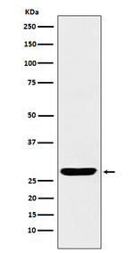 SCGN Recombinant Rabbit Monoclonal Antibody (K01_3P56)