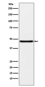 Podocin Recombinant Rabbit Monoclonal Antibody (K01_3P59)
