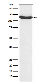 hnRNP U Recombinant Rabbit Monoclonal Antibody (K01_3P60)