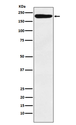 IQGAP1 Recombinant Rabbit Monoclonal Antibody (K01_3P67)