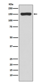 RNA polymerase beta Recombinant Rabbit Monoclonal Antibody (K01_3P72)