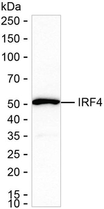IRF4 Recombinant Rabbit Monoclonal Antibody (K01_3P74)