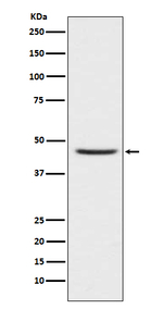 CCR8 Recombinant Rabbit Monoclonal Antibody (K01_3P77)