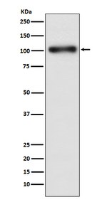 GABBR1 Recombinant Rabbit Monoclonal Antibody (K01_3P78)
