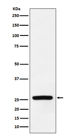 SOD3 Recombinant Rabbit Monoclonal Antibody (K01_3P79)