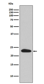 SNAP23 Recombinant Rabbit Monoclonal Antibody (K01_3P82)