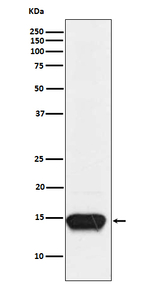 FABP3 Recombinant Rabbit Monoclonal Antibody (K01_3P87)