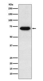 CD39 Recombinant Rabbit Monoclonal Antibody (K01_3P89)