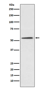 Protein C Antibody in Western Blot (WB)