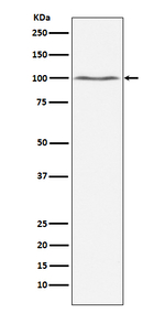 Dynamin 2 Recombinant Rabbit Monoclonal Antibody (K01_3P99)