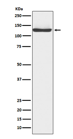 JAK3 Recombinant Rabbit Monoclonal Antibody (K01_3Q01)