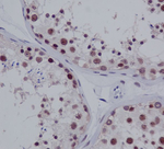 PIAS1/PIAS2 Recombinant Rabbit Monoclonal Antibody (K01_3Q05)