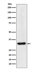 hnRNP A1 Recombinant Rabbit Monoclonal Antibody (K01_3Q09)