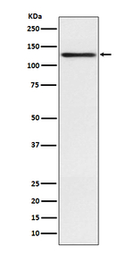 Involucrin Recombinant Rabbit Monoclonal Antibody (K01_3Q10)