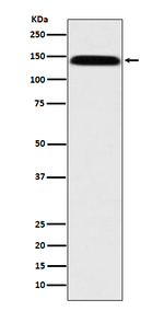 Leptin Receptor Recombinant Rabbit Monoclonal Antibody (K01_3Q13)